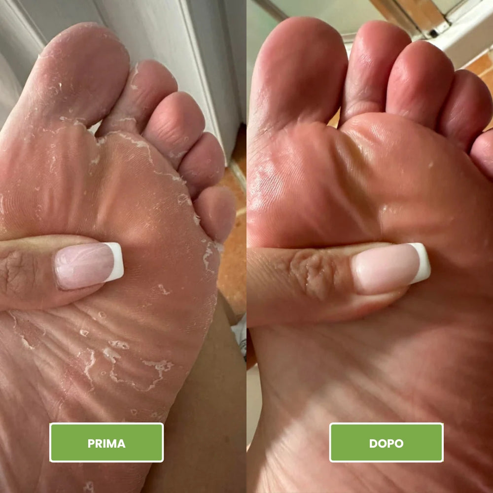 Saponetta antimicotica per Piedi