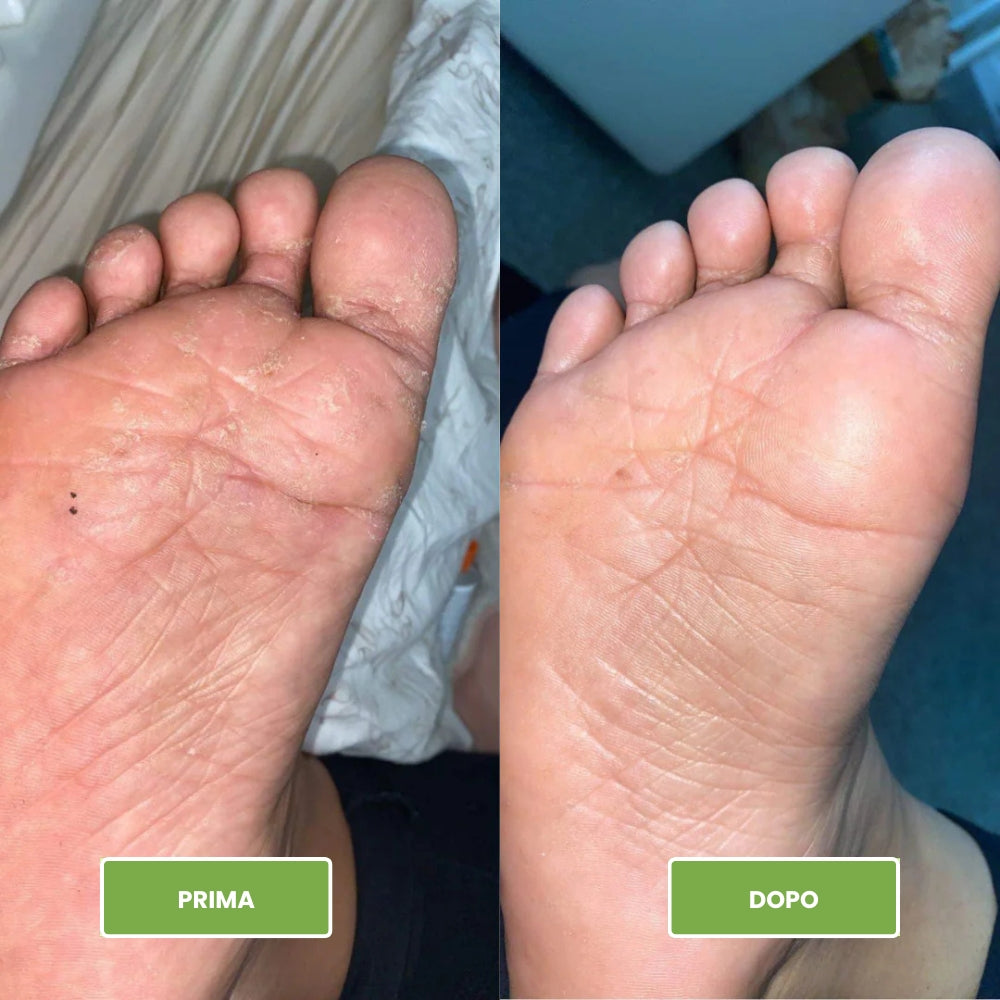 Saponetta antimicotica per Piedi